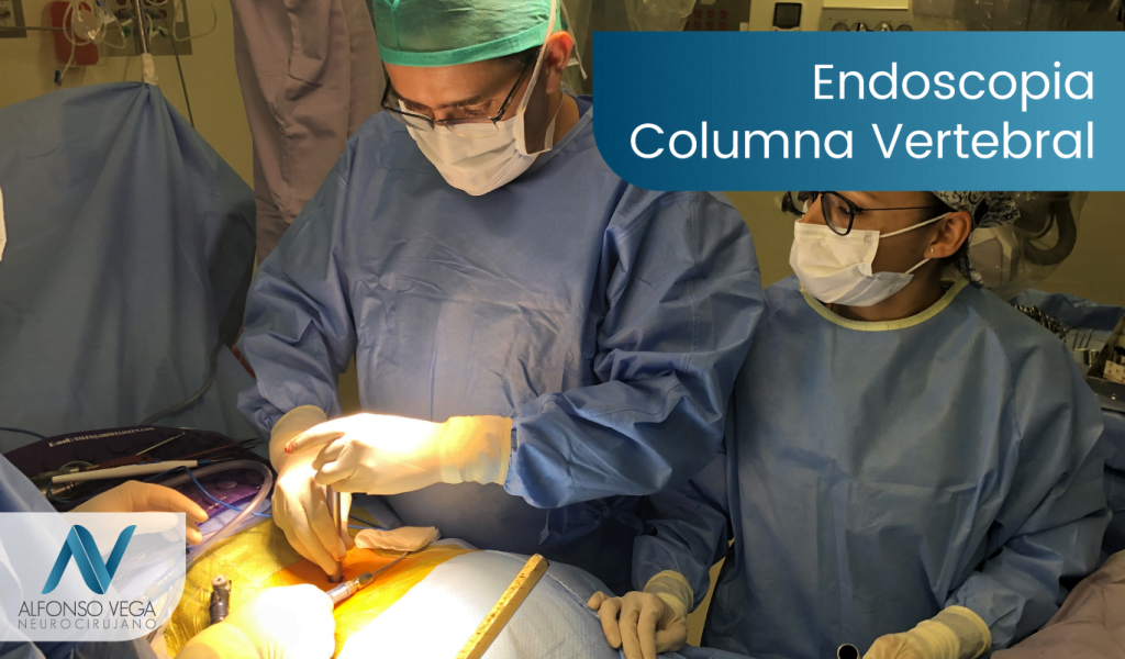 ¿Qué es una endoscopia de columna vertebral?