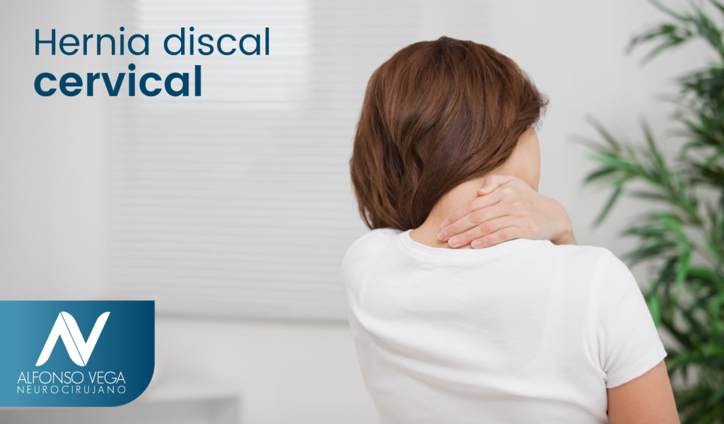 Tratamiento de una hernia discal cervical