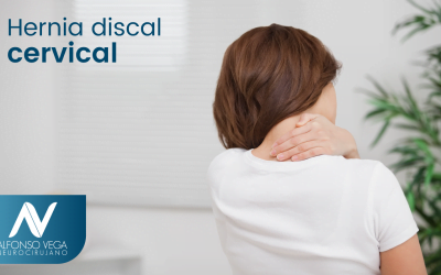 ¿Cuál es el tratamiento de una hernia discal cervical?