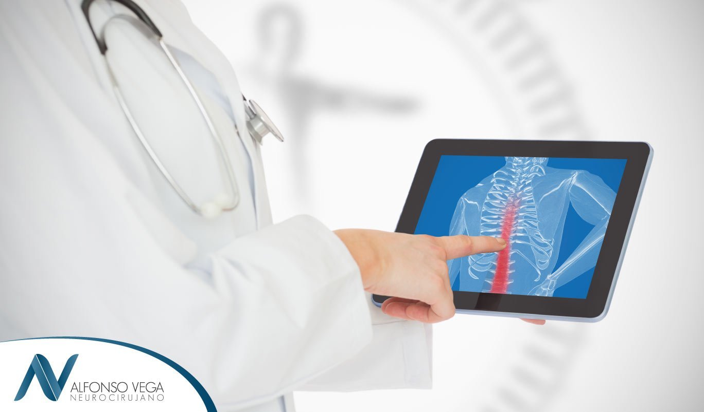 Espondilolistesis: causas, síntomas y tratamiento