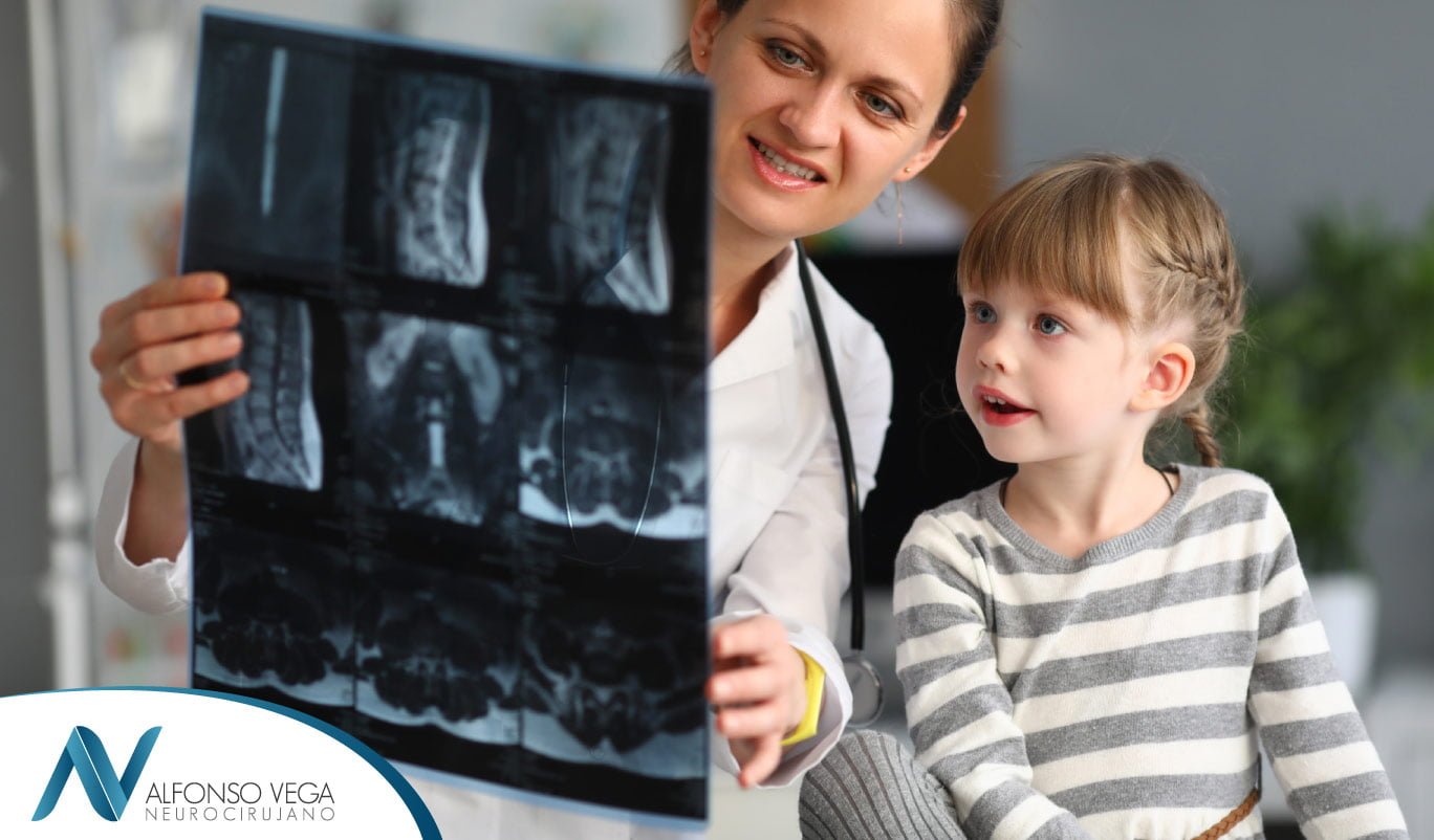 Escoliosis: síntomas, causas y tratamiento