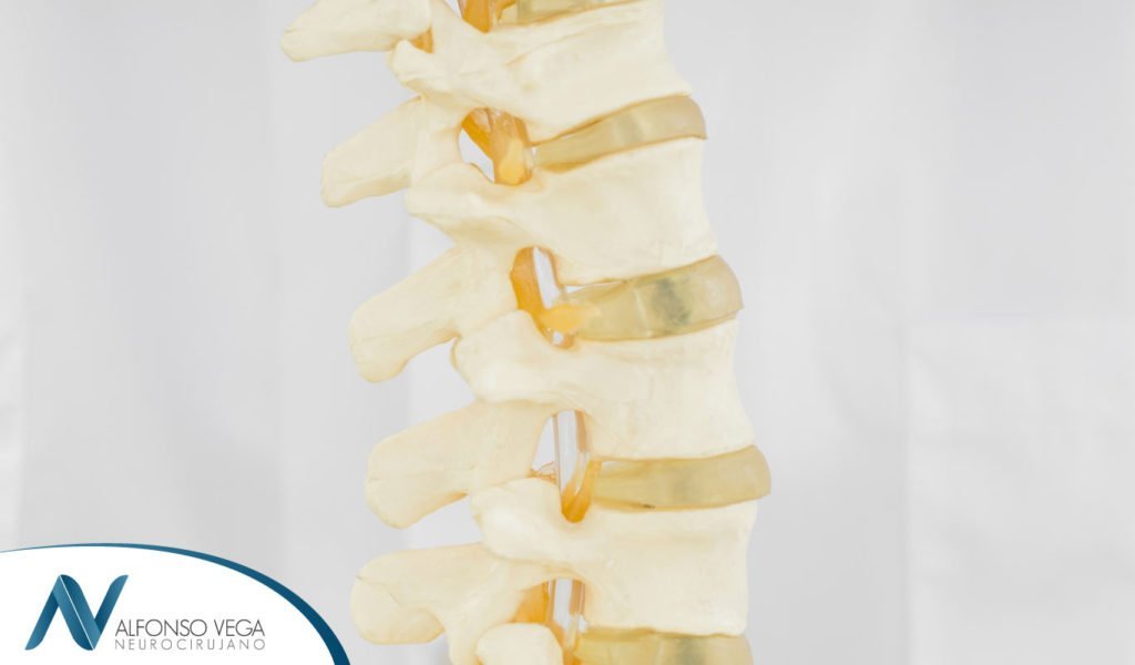 Deshidratación discal