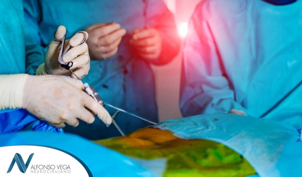 En qué consiste una cifoplastia