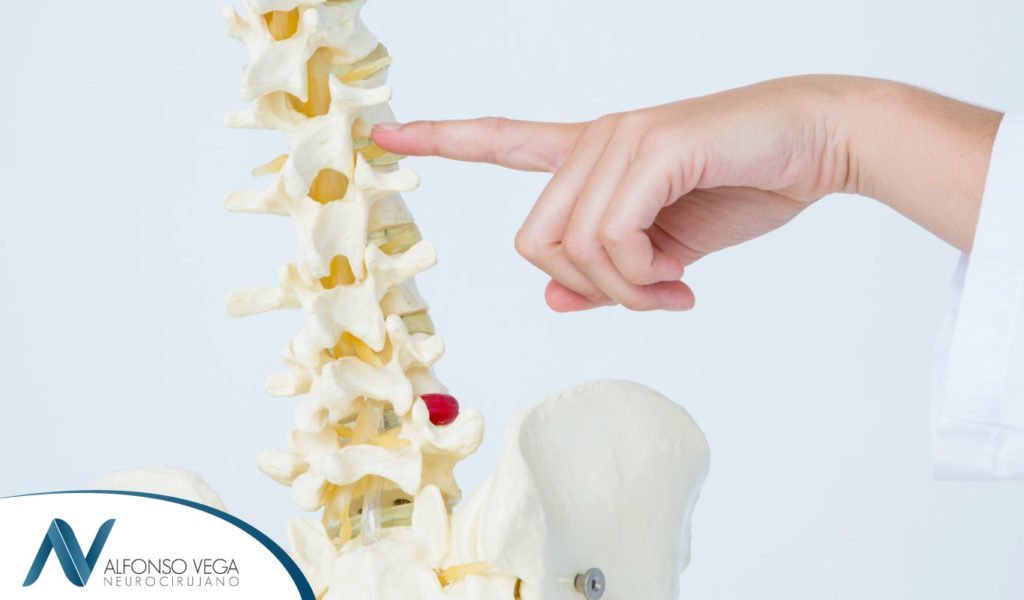Datos que debes conocer sobre la columna vertebral