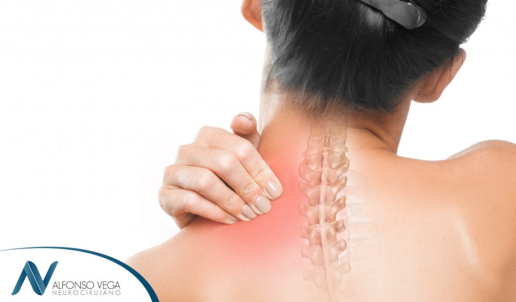 Espondilosis cervical: síntomas, causas y tratamiento