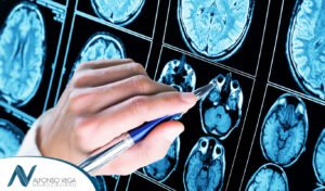Avances tecnológicos en la neurocirugía