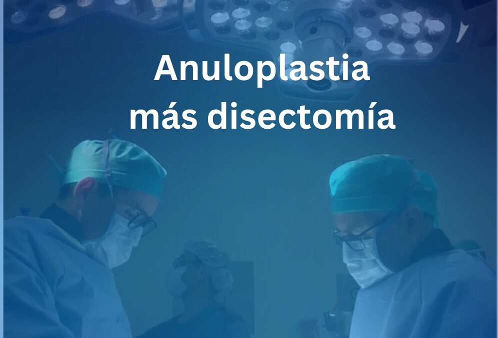 Anuloplastia más disectomía: Una combinación quirúrgica para el tratamiento de la hernia discal