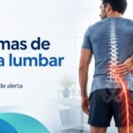 Síntomas de hernia lumbar con dolor ciático y compresión nerviosa